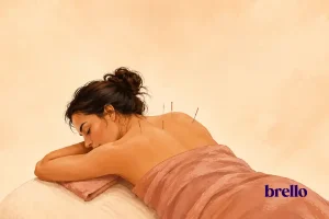 Featured image for Acupuncture